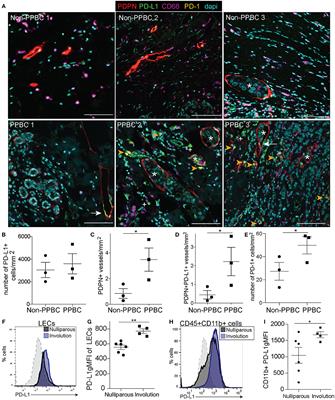 PD-1 Blockade During Post-partum Involution Reactivates the Anti-tumor Response and Reduces Lymphatic Vessel Density